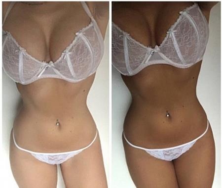 “Ngôi sao giảm cân” gây sốc với ảnh khoe nội y - 2 Holly gây sốc với ảnh khoe thân táo bạo