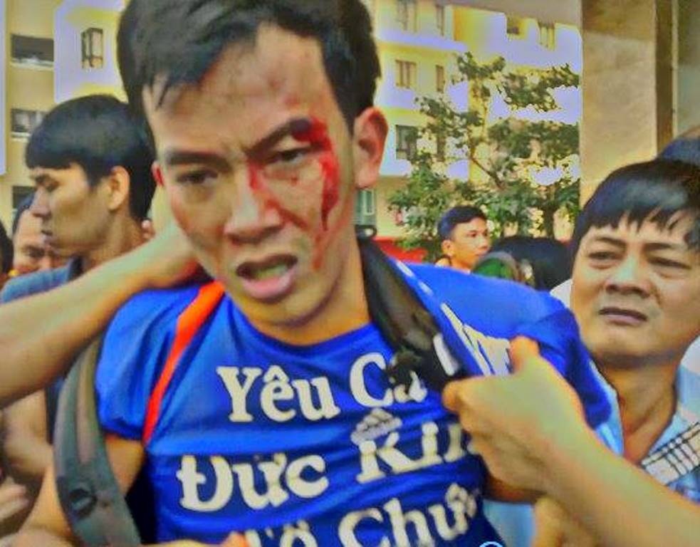 Vụ dân chung cư bị côn đồ đánh thương tích: Chủ đầu tư nói vô can? - 4 Những hình ảnh tại cuộc xô xát khiến cư dân bị thương