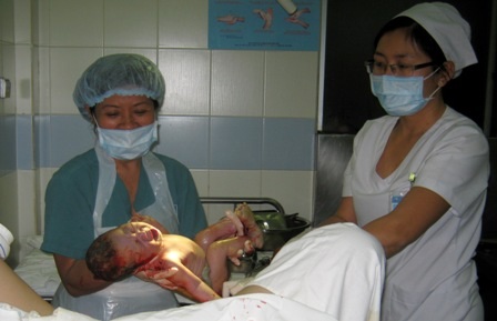 Thủ thuật kéo thai nhi hỗ trợ sinh sản có thể khiến trẻ bị liệt đám rối dây thần kinh
