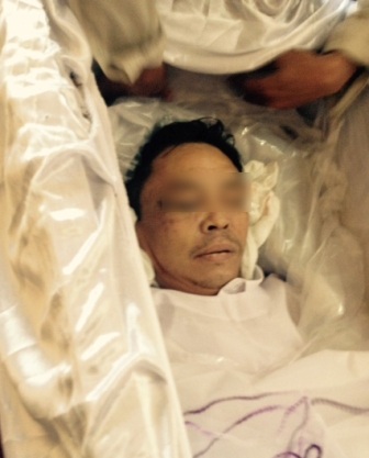 Bệnh nhân đã bị những người cùng phòng đánh chấn thương sọ não dẫn tới tử vong (ảnh: gia đình cung cấp)