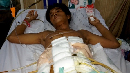 Vợ nghèo đau đớn nhìn chồng nguy kịch vì tai nạn giao thông - 2
Anh Định khao khát được sống để thấy hai con thơ khốn lớn