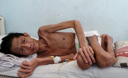 
Anh Phong đã phải cắn răng chịu đau đớn hành hạ thân xác gần một năm qua
