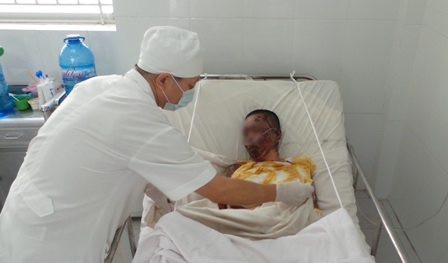 Bỏng lửa xăng, tai nạn rất nguy hiểm, nhiều vụ xảy ra do sự bất cẩn của nạn nhân