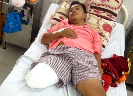 Bệnh nhân Hoàng Lâm với chân phải bị cắt cụt ngang đùi (ảnh do gia đình cung cấp)