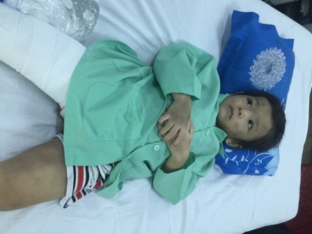 Bé trai 4 tuổi bị cha dượng cùng mẹ đẻ đánh gãy xương đùi - 2 Bé trai 4 tuổi bị cha dượng cùng mẹ đẻ đánh gãy xương đùi - 2