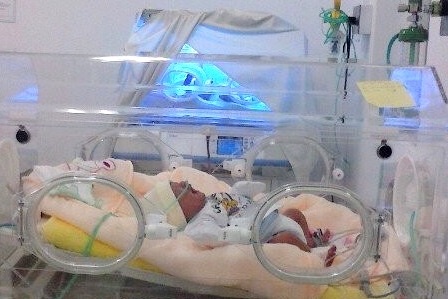 Cứu sống bé nặng 900g chỉ nằm trong bụng mẹ 5 tháng - 1 Bé gái chào đời khi mới được 5 tháng của thai kỳ nên phải nằm lồng ấp