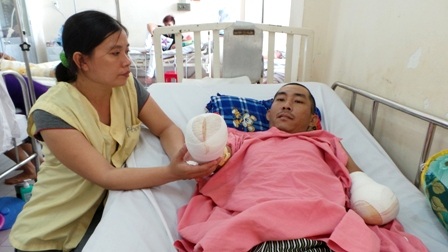 Báo động hàng loạt phế nhân do tai nạn bỏng điện - 2