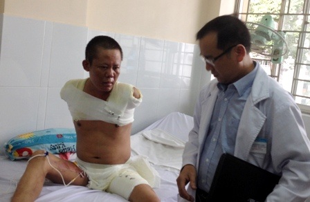 50% nạn nhân bị bỏng điện phải đoạn chi gây ảnh hưởng nghiêm trọng đến chất lượng sống