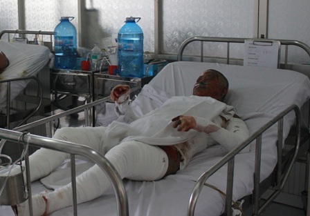 Nạn nhân đang được điều trị tại bệnh viện Chợ Rẫy nhưng tiên lượng rất dè dặt