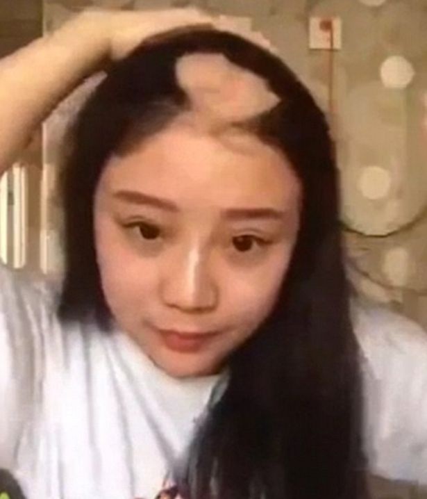 Hậu quả không ngờ của trò đùa dại... ăn ngô bằng máy khoan - 2 Hậu quả không ngờ của trò đùa dại... ăn ngô bằng máy khoan - 2