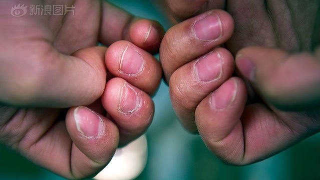 Cô gái 9x kiếm 33 triệu trong 2 ngày nhờ... gấp quần áo thuê - 7 Công việc mang tới cho cô thu nhập tốt, nhưng bàn tay thường xuyên bị tê mỏi