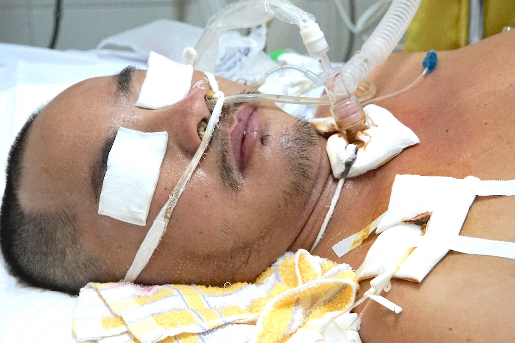 Nguy kịch tính mạng sau khi đá bóng bị toác chân - 14 Anh Tuyên giờ đang được các bác sỹ theo dõi sát sao. Theo các bác sỹ, nếu có tiền lọc máu thêm 3 lần nữa sẽ cứu được mạng sống anh Tuyên.