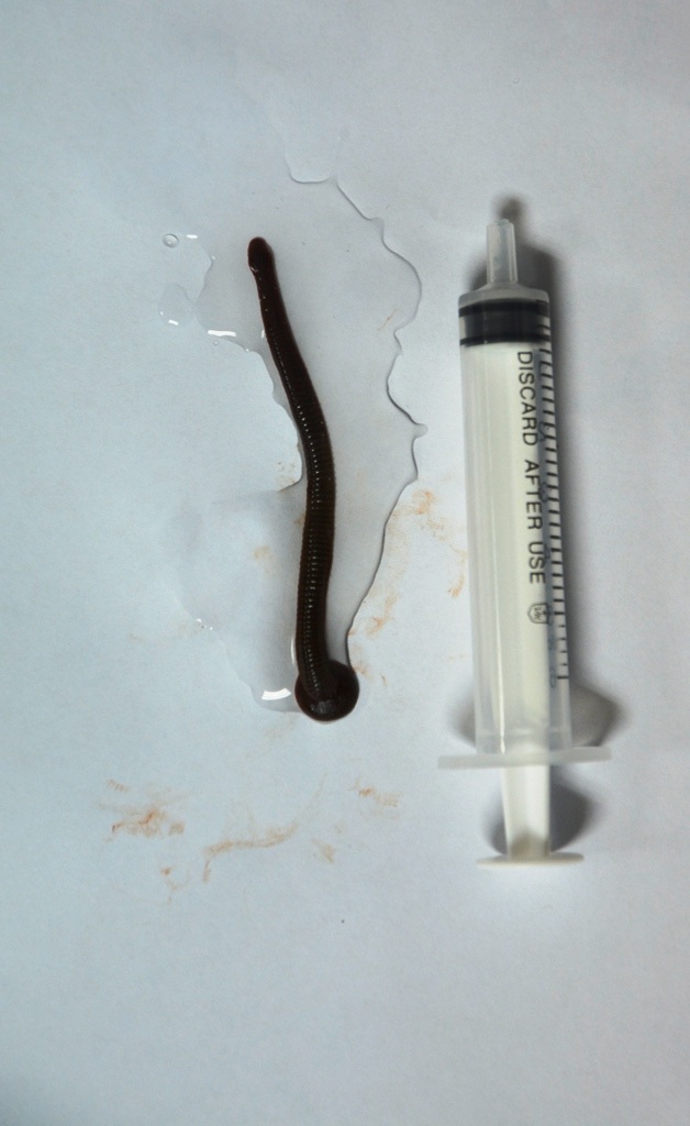 Con đỉa được gắp ra dài 7 cm.