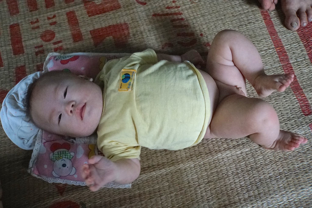 Cha mẹ nghèo đau đớn trước cảnh con trai 6 tháng tuổi mắc bệnh nan y - 2 Chu Văn Tuấn (SN 2016) bị bệnh dow.