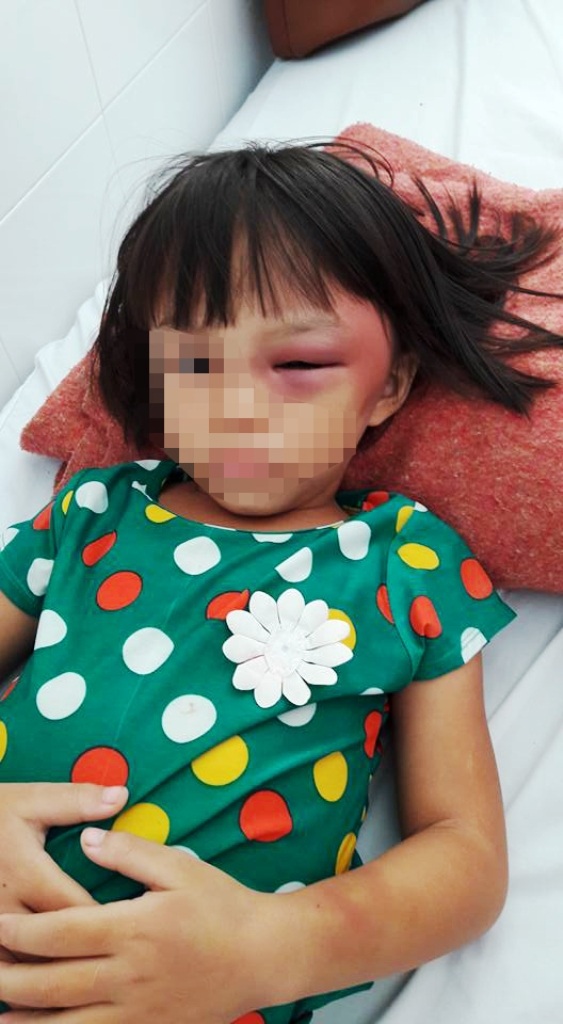 Nghi án bé gái 7 tuổi bị mẹ kế bạo hành - 3
Thành viên Đội cứu nạn giao thông tình nguyện tỉnh Tây Ninh góp tiền đưa cháu T. đi bệnh viện điều trị