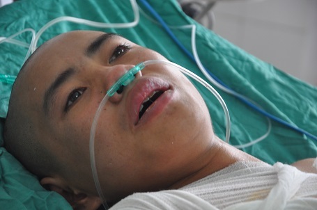 Bị bỏng điện khi đang đi sơn nhà thuê khiến em Trần rơi vào tình cảnh thập tử nhất sinh.