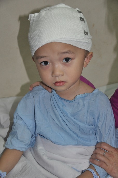 5 tuổi, bé Trung phát hiện u não.