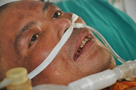 Với 21% bỏng sâu độ 2,3,4.