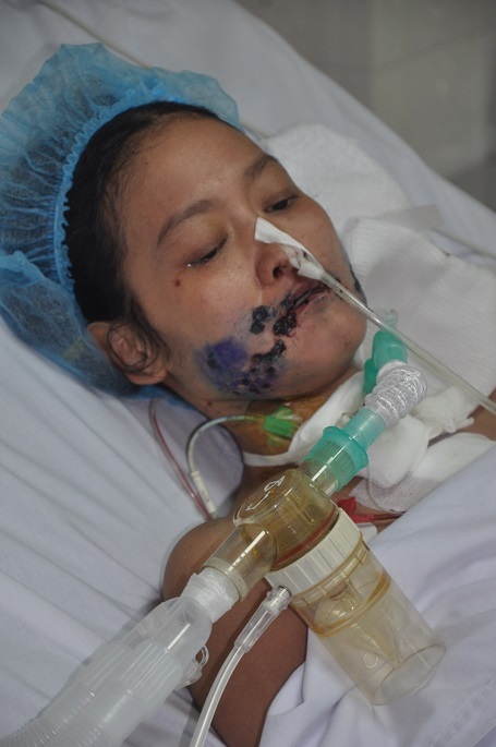 Chị Hương đã được phẫu thuật, tuy nhiên đang trong thời gian hồi sức, chị phải dùng nhiều loại thuốc kháng sinh đắt tiền.