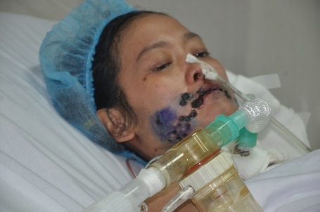 Chị khao khát sống để được trở về với 3 đứa con thơ.