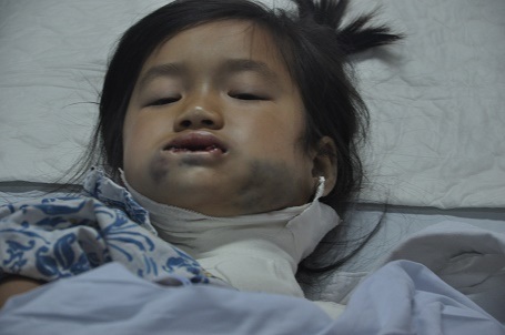 Khối u của em có thể tái phát bất cứ khi nào