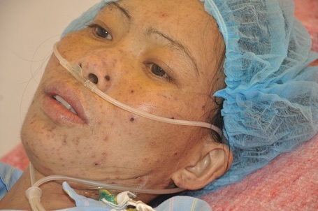 Bị suy tim nặng, cần tiền mổ nhưng chị Đẹp không biết lấy đâu ra tiền.