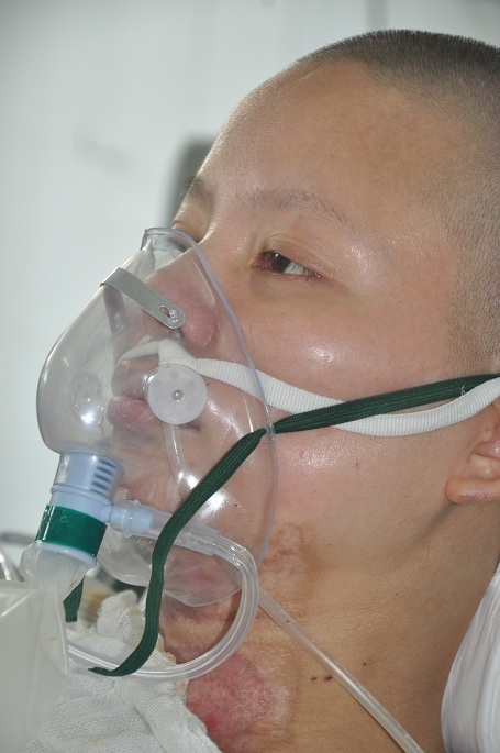 Tuy nhiên theo đánh giá của bác sĩ chị có khả năng phục hồi nếu được tiếp tục điều trị tích cực.