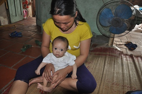 Mắc tim bẩm sinh khiến bé Chung dặt dẹo, bé nhỏ.