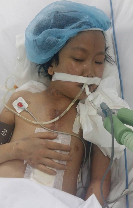 Tiếng kêu cứu khẩn cấp của bé gái có trái tim dị thường - 1 Đã trải qua 2 ca mổ và sẽ còn phải mổ tiếp, tuy nhiên bé Ngọc Trâm đang trong tình cảnh nguy kịch.