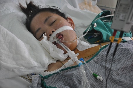 Chị gái em là em Nguyễn Thị Thúy được chẩn đoán viên cơ tim.