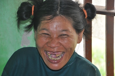 Con gái bà chị Nguyễn Thị Tươi nay đã 46 tuổi nhưng không khác gì 1 đứa trẻ.