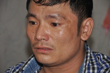 Bị hội chứng thực bào liên quan đến nhiễm trùng nhưng anh Tiềm không có tiền đi chữa bệnh.