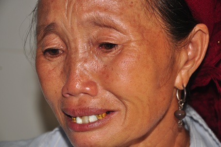 Cô Mẩy bị 2 bệnh van tim đó là hẹp hở van 2 lá và hẹp hở van động mạch chủ đồng thời có huyết khối hết trong buồng tim