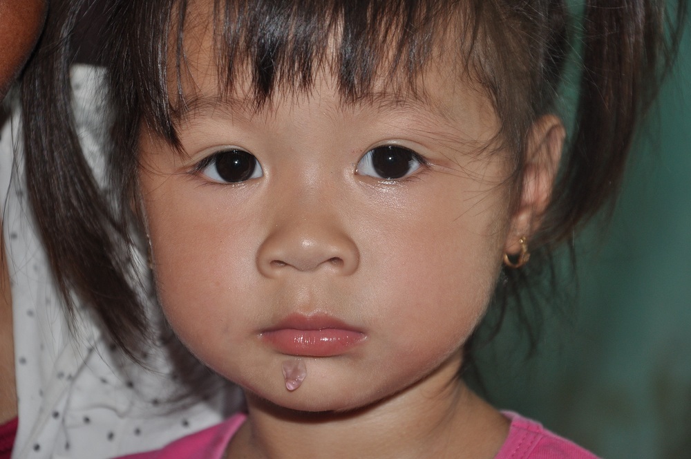 Gương mặt ngây thơ của bé Tuyết chưa biết chuyện gì xảy đến với mình.