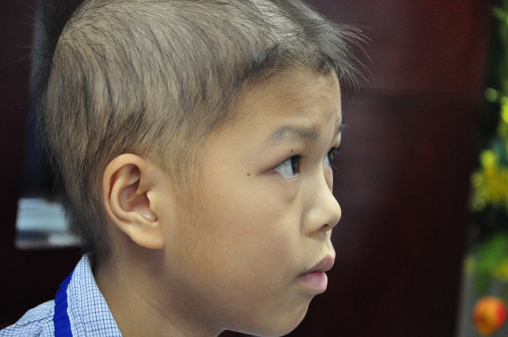 Em phát hiện căn bệnh ung thư máu và hiện đang đánh hóa chất đợt 1.