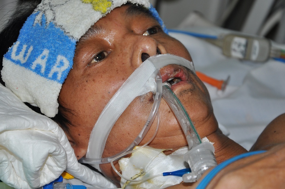 Anh Đức phát hiện bị viêm tụy cấp sau trận đau bụng dữ dội và đã điều trị 2 tháng trong phòng Hồi sức cấp cứu - BV Bạch Mai.