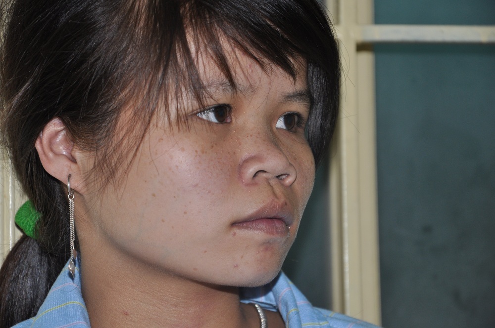 Bị mắc bệnh từ lâu nhưng vì không có tiền đi chữa nên bao năm nay Hương vẫn ở nhà như vậy.