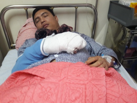 Đi ăn đêm, bị nhóm côn đồ truy sát, chém đứt lìa 2 ngón tay - 1 Anh Vũ Khắc Duy bị nhóm đối tượng chém đứt lìa hai ngón tay, đang nằm điều trị tại Bệnh viện Xanh Pôn.