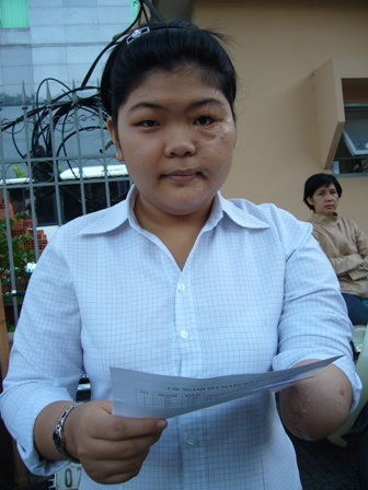 Mất 1 cánh tay, vẫn đi thi đại học - 1