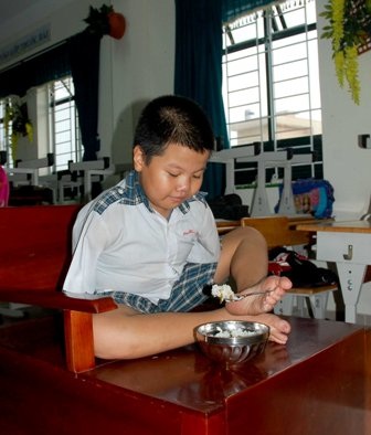 Khâm phục sức sống từ đôi chân diệu kỳ - 11 Khâm phục sức sống từ đôi chân diệu kỳ - 11
