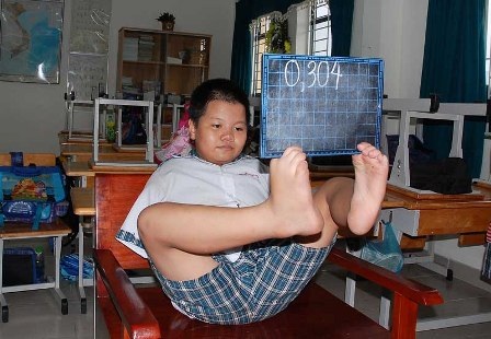 Khâm phục sức sống từ đôi chân diệu kỳ - 7 Khâm phục sức sống từ đôi chân diệu kỳ - 7