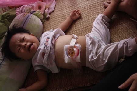 Bé 27 tháng tuổi đối mặt nhiều bệnh hiểm nghèo - 1
