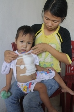 Ca phẫu thuật tim của cháu Đậu Hoàng Tiến thành công - 1