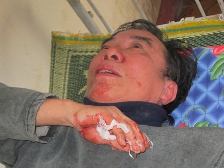 Vụ Tổng Biên tập "tố" bị đánh: Công an huyện Kỳ Anh đã thụ lý hồ sơ  - 1