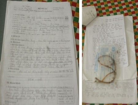 Hà Tĩnh: Phát hiện dị vật sau 2 năm mổ sỏi thận - 2 Hồ sơ bệnh án của chị Hồng và dị vật được lấy ra từ bệnh nhân.