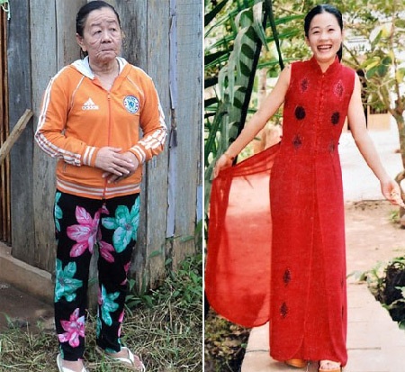Cô gái biến thành bà lão có thể sinh con bình thường? - 1