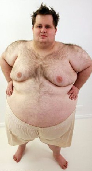 Gặp gỡ chàng trai có vòng bụng “đè bẹp” chiều cao