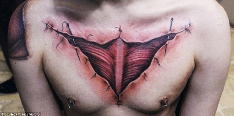 Con mắt mọc ở trên cánh tay?