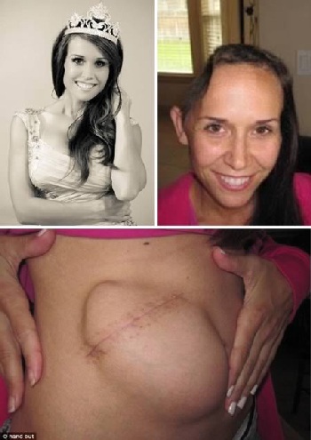 Bảo quản hộp sọ trong bụng