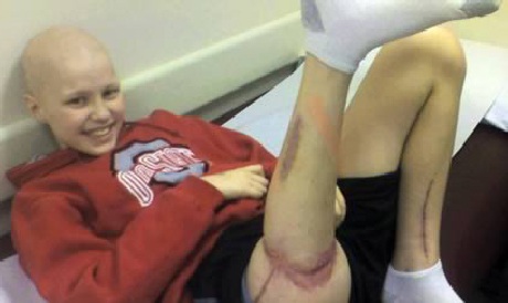 Bảo quản hộp sọ trong bụng